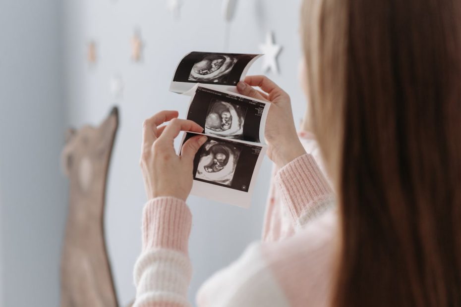 Depresión Perinatal